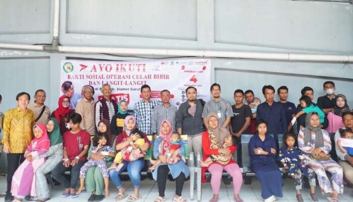 Layanan Operasi Gratis Bibir Sumbing Di RSUD dr. Slamet Garut