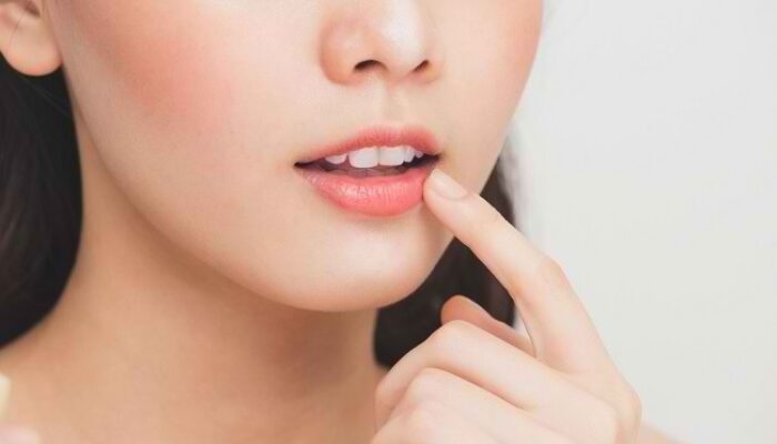 Tips Efektif Mengatasi Bibir Kering dan Pecah-pecah